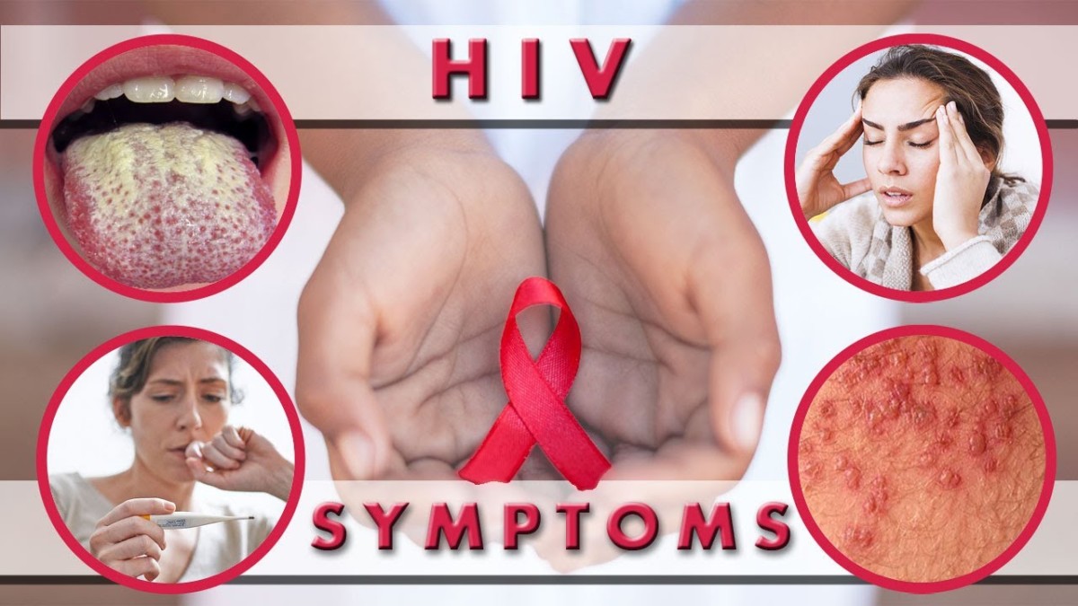 symptoms-of-hiv-infection-viral-ventura