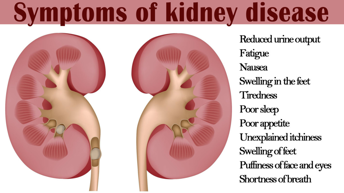 Image result for kidney failure symptoms