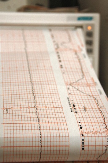 heart-monitor